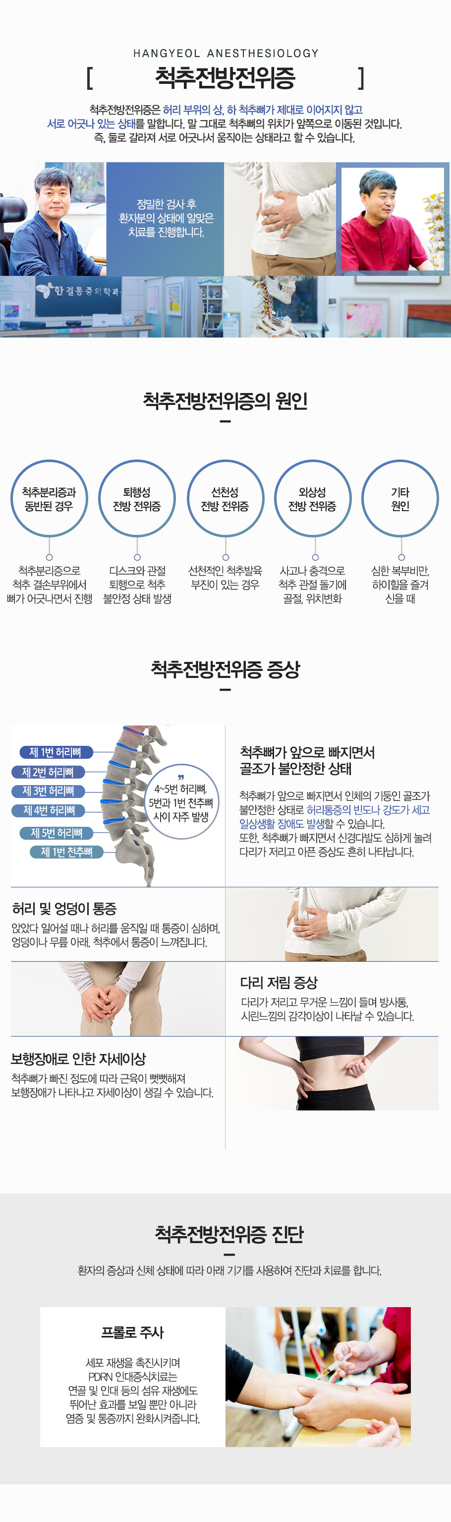 척추전방위전증